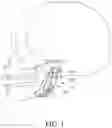 Fig. 02 - Temporomandibular joint prosthesis