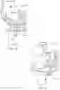 Fig. 08 - ANATOMICAL MOTION HINGED PROSTHESIS