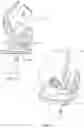 Fig. 10 - ANATOMICAL MOTION HINGED PROSTHESIS