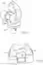 Fig. 16 - ANATOMICAL MOTION HINGED PROSTHESIS