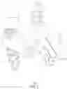 Fig. 09 - Rhomboid shaped implants