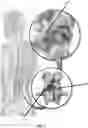 Fig. 02 - Methods and Implants for Facet Joint Stabilization or Fusion