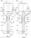 Fig. 10 - Methods and Implants for Facet Joint Stabilization or Fusion