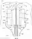Fig. 16 - Methods and Implants for Facet Joint Stabilization or Fusion