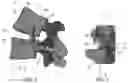 Fig. 02 - Pedicle-based intradiscal fixation devices and methods