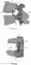Fig. 09 - Pedicle-based intradiscal fixation devices and methods