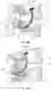 Fig. 16 - Pedicle-based intradiscal fixation devices and methods
