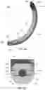 Fig. 18 - Pedicle-based intradiscal fixation devices and methods