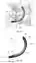 Fig. 20 - Pedicle-based intradiscal fixation devices and methods