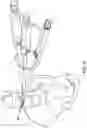 Fig. 80 - Expandable inter-body device, system and method