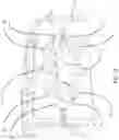 Fig. 19 - Dual wedge expandable implant, system and method of use