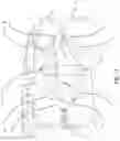 Fig. 19 - Dual wedge expandable implant with eyelets, system, and method of use