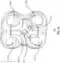 Fig. 47 - Dual wedge expandable implant with eyelets, system, and method of use