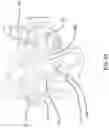 Fig. 51 - Dual wedge expandable implant with eyelets, system, and method of use