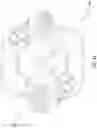 Fig. 52 - Dual wedge expandable implant with eyelets, system, and method of use