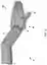 Fig. 16 - Surgery instruments with a movable handle