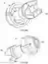 Fig. 31 - Surgery instruments with a movable handle