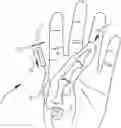 Fig. 01 - Tool for reaming a carpal bone