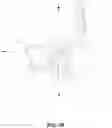 Fig. 11 - Low-cost prosthetic apparatus, methods, kits, and systems with improved force transfer elements