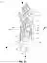 Fig. 14 - Low-cost prosthetic apparatus, methods, kits, and systems with improved force transfer elements