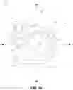Fig. 17 - Low-cost prosthetic apparatus, methods, kits, and systems with improved force transfer elements