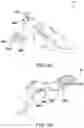 Fig. 09 - Prosthetic Partial Fingers