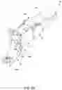 Fig. 10 - Prosthetic Partial Fingers