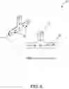 Fig. 14 - Prosthetic Partial Fingers