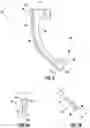 Fig. 04 - Devices and methods for stent graft extraction