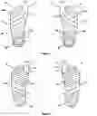 Fig. 02 - Pair of supportive socks for disorders caused by foot deformities