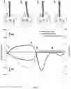 Fig. 13 - Differential and variable stiffness orthosis design with adjustment methods, monitoring and intelligence