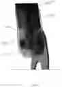 Fig. 16 - Differential and variable stiffness orthosis design with adjustment methods, monitoring and intelligence