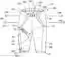 Fig. 01 - ORTHOPEDIC DEVICE FOR TREATING COMPLICATIONS OF THE HIP