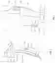 Fig. 03 - ORTHOPEDIC DEVICE FOR TREATING COMPLICATIONS OF THE HIP