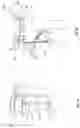 Fig. 07 - ORTHOPEDIC DEVICE FOR TREATING COMPLICATIONS OF THE HIP