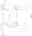 Fig. 22 - ORTHOPEDIC DEVICE FOR TREATING COMPLICATIONS OF THE HIP
