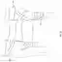 Fig. 23 - ORTHOPEDIC DEVICE FOR TREATING COMPLICATIONS OF THE HIP