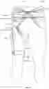 Fig. 29 - ORTHOPEDIC DEVICE FOR TREATING COMPLICATIONS OF THE HIP