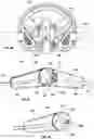 Fig. 32 - ORTHOPEDIC DEVICE FOR TREATING COMPLICATIONS OF THE HIP