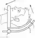 Fig. 01 - Head and Neck Stabilizing Apparatus