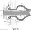Fig. 08 - INTESTINAL WASTE MANAGEMENT SYSTEM