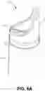 Fig. 05 - Intravaginal device