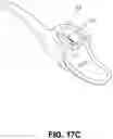 Fig. 15 - Intravaginal device