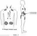 Fig. 02 - Localized cooling to induce browning of adipose tissue