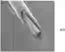 Fig. 01 - Medical implant