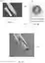 Fig. 05 - Medical implant