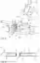 Fig. 05 - CONTROLLING INTRAOCULAR PRESSURE DURING PHACOEMULSIFICATION PROCEDURES