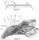 Fig. 02 - Glaucoma device inserter