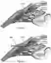 Fig. 03 - Glaucoma device inserter