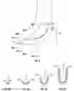 Fig. 06 - Devices, systems and methods for minimally invasive glaucoma surgery